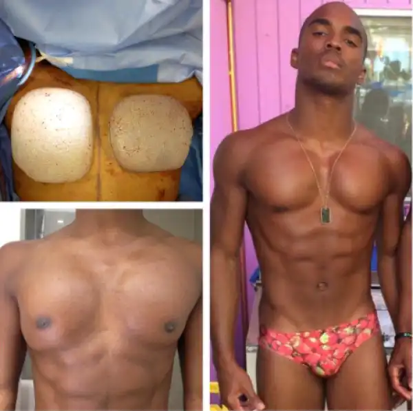 Wait...Guys do chest implants? (Photos)